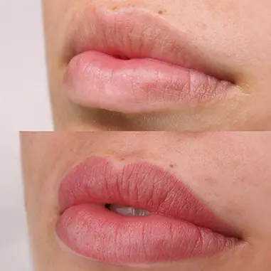 Micropigmentação labial, antes e depois